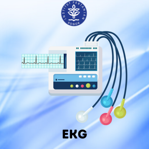 EKG