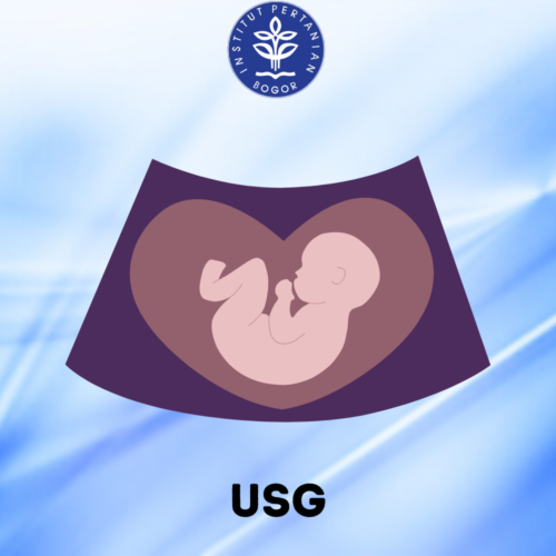 USG